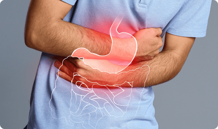 Gastroesophageal Reflux Disease (GERD)