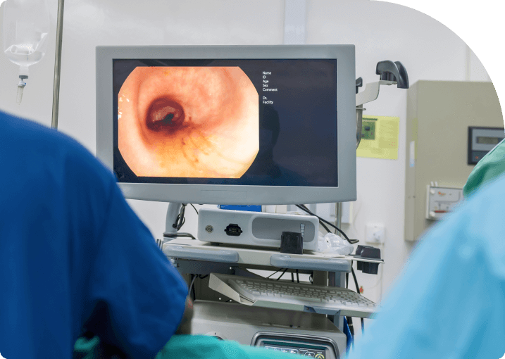 Colonoscopy